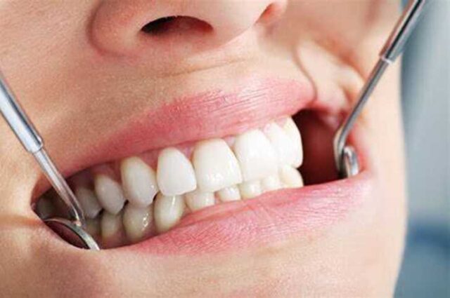 How To Choose A Dental Implant Center For You